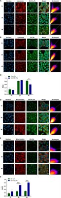 A mitochondria-targeted nano-platform for pancreatic cancer therapy